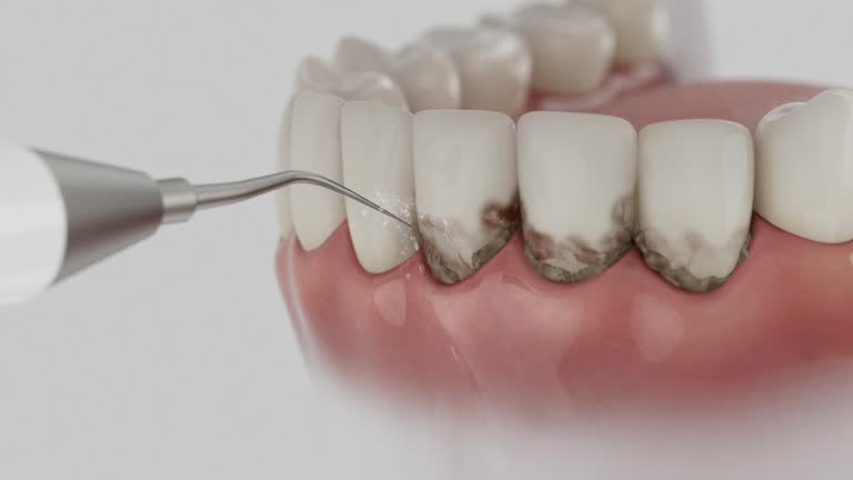 Reliable Teeth Cleaning And Checkup contractor in Franklin County County, IA by Dentist Open Now